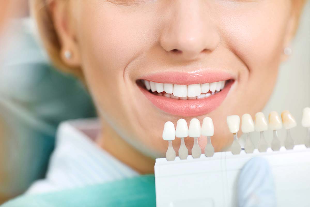 Dental Whitening Treatment