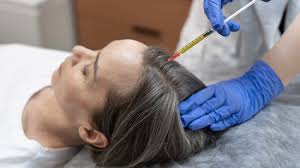 best hair transplant clinic london