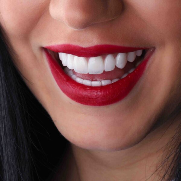 Best Lip Filler Treatments in Dubai