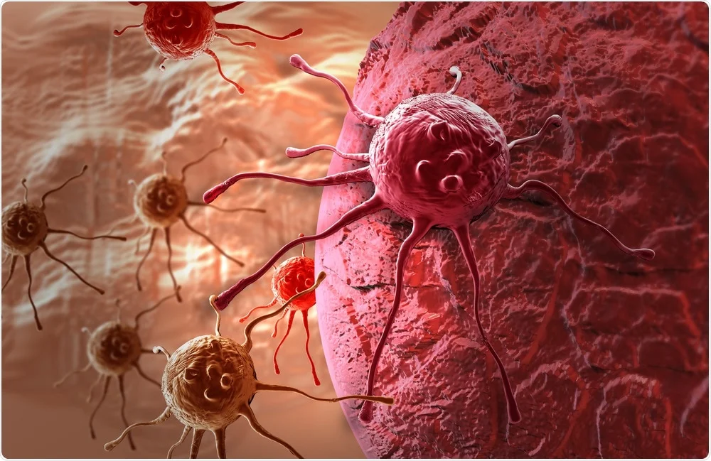 cancer detection